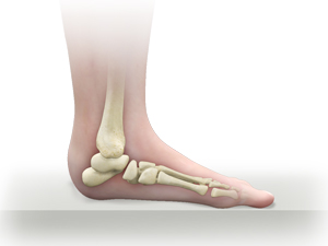 Pediatric Foot Conditions