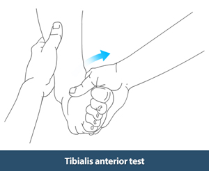 Anterior Tibialis Tendon Repair