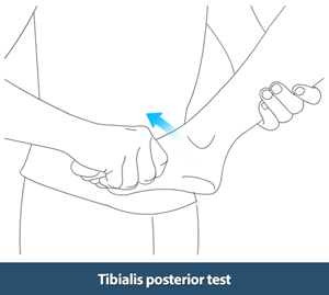 Posterior Tibialis Tendon Repair