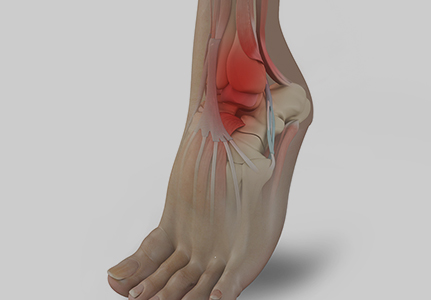 Fractures and Trauma